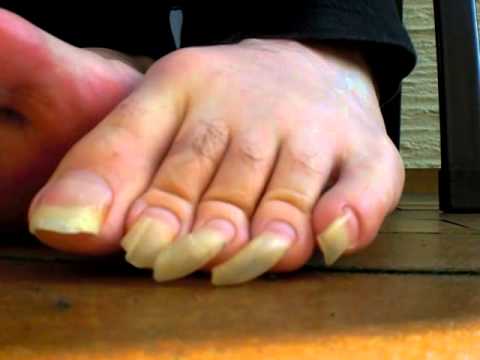 optimized-nastytoenails