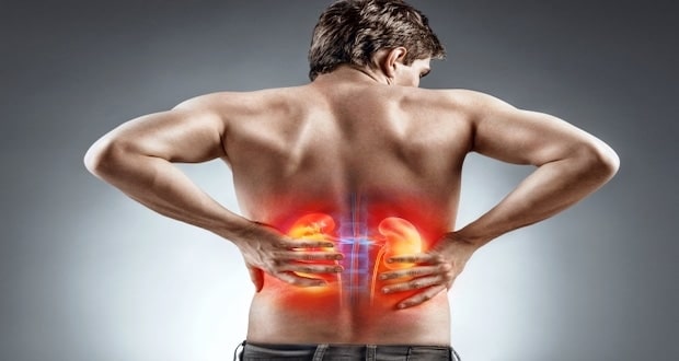 avoiding common kidney stones risk factors-kidney stones