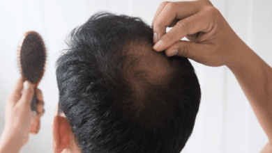 Effective Tips For Thinning Hair - a man examining the bald spot at the top of his head